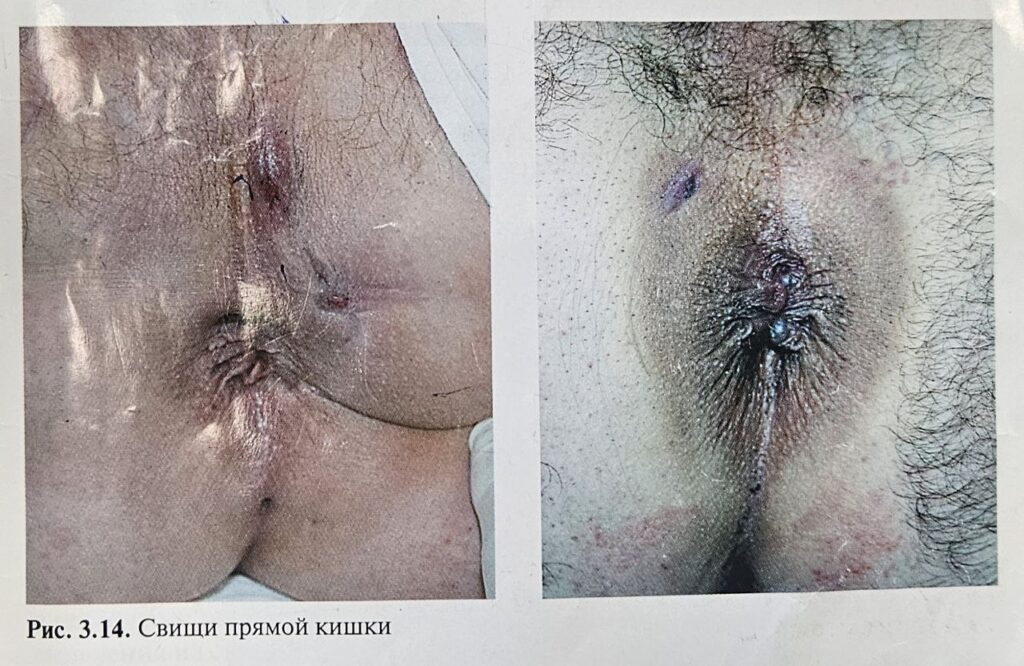 Колготки порно ВК Порнода көп сперматозоидты қалай жасауға болады